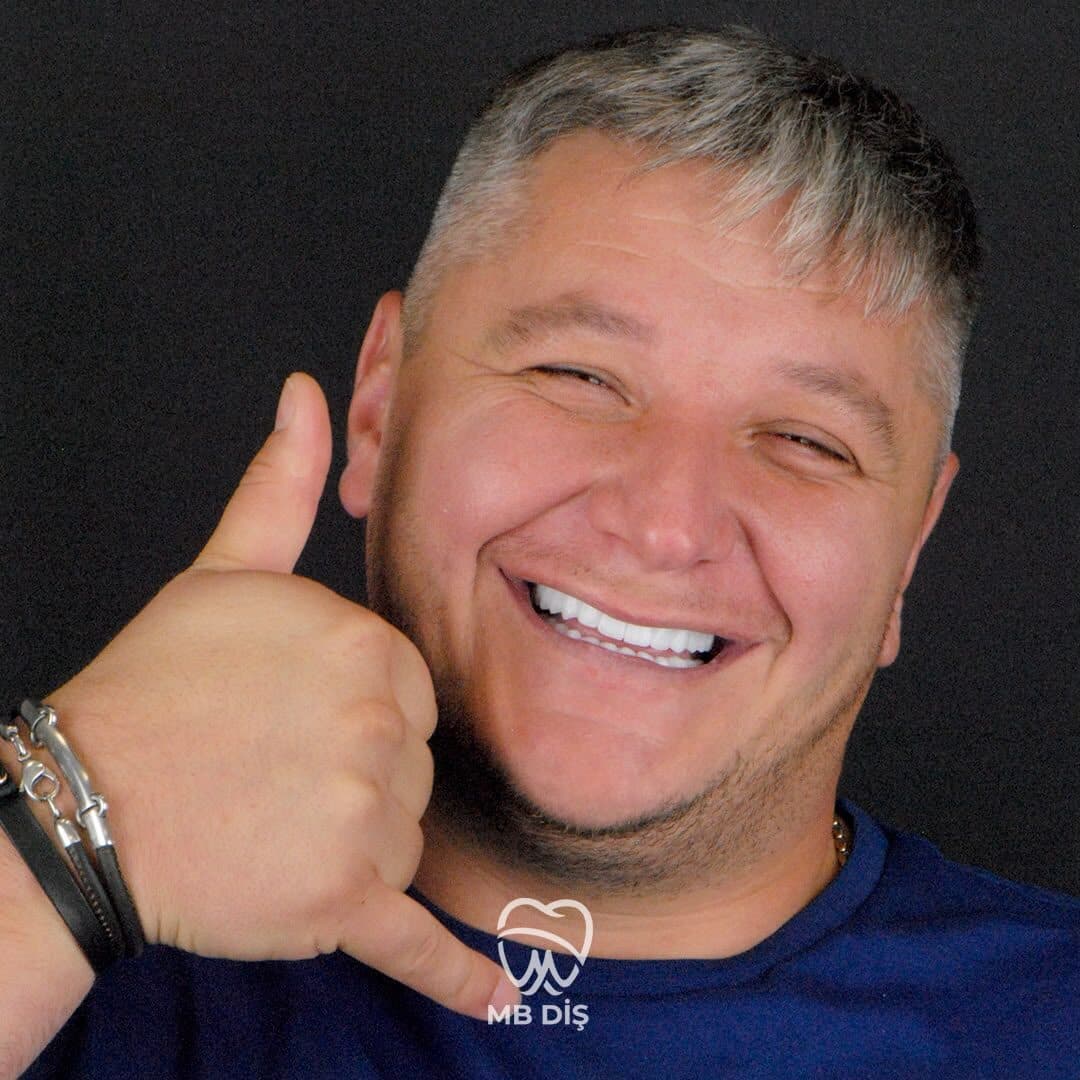 The smile of a patient whose treatment was completed at MB Diş Kliniği 16