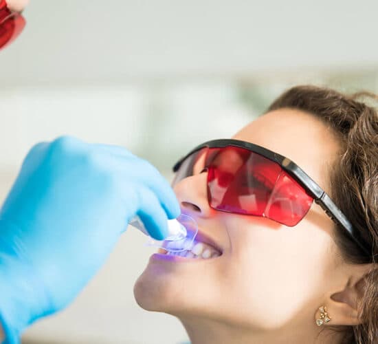 Teeth whitening with ultraviolet light