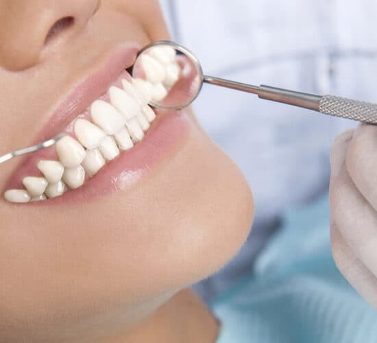 Checking an aesthetic dental veneer